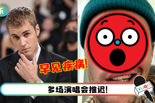Justin Bieber患上罕见疾病！ 无法控制脸部表情…右边脸完全面瘫！