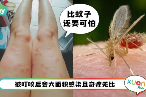Tips I 海边遇沙蝇叮咬奇痒无比！露营粉都爱用这些方法止痒