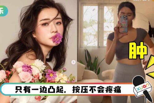 秋雯胯部突肿一大包！ 吓坏：有一点害怕