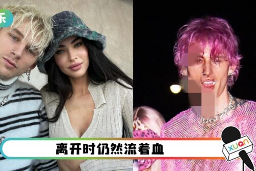 Megan Fox男友自我爆头!满头鲜血进行演出