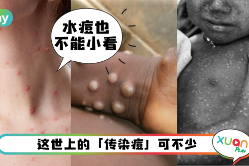 科普｜原来还有牛痘？到底水痘、猴痘、天花有什么不同？