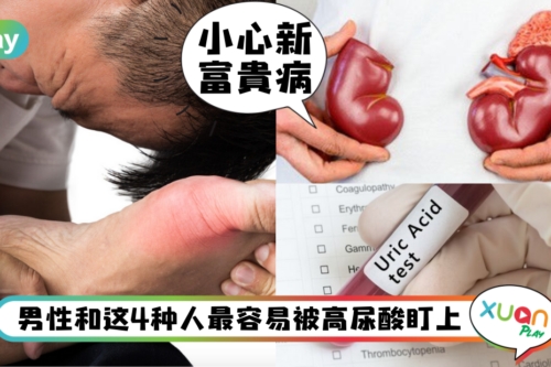 健康｜“三高杀手”已经out了！你现在要预防的是“第四高”！