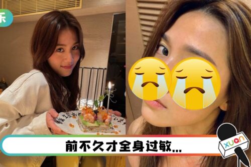 周秀娜脸部过敏！ 红肿毁容模样曝光