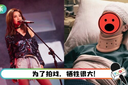 阿Sa惊悚毁容样曝光! 全脸淤血+疤痕…粉丝都认不出