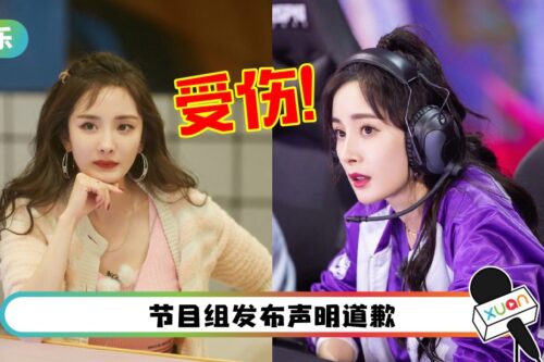 杨幂录《密逃》受伤！捂着脸上救护车…被证实“险瞎眼”