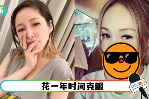 萧亚轩不再遮伤疤！素颜照获赞：怎样都很美