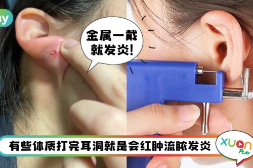 生活 I 爱美不成变灾难！有5种人特别不适合打耳洞