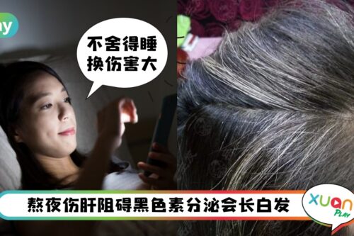 健康 I 熬夜会提升长白发的机率！日常养肝简单5方式