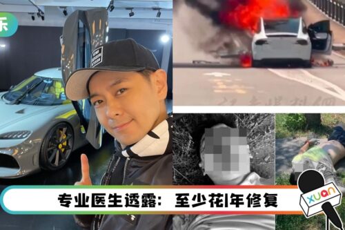 林志颖“颜面骨折” 可能需整型！网忧：不老神颜要陨落了吗