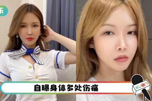 Gatita健康出状况！反复发烧、咳不停 强调“不是COVID”