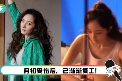 杨幂路透照曝光！ 眼角伤势已痊愈