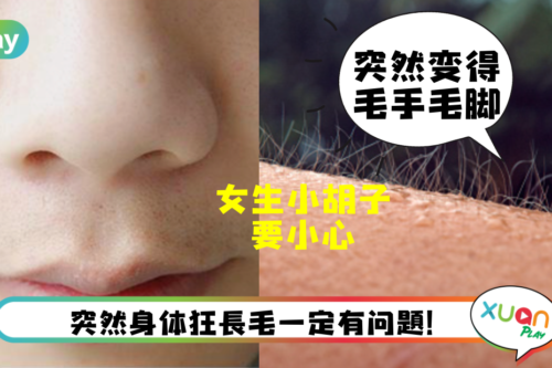 健康｜女生突然体毛旺盛可别忽略，可能就是卵巢出事了！