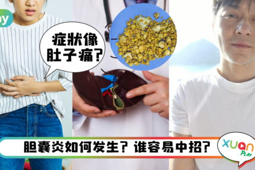 健康｜张智霖胆囊炎紧急停工，不定时吃饭的人最高危！