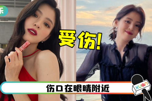 韩素希拍戏出意外 被送急诊室！官方曝伤势