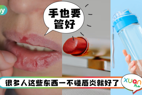Tips｜唇炎总是好不了？这5种东西绝对别碰唇！