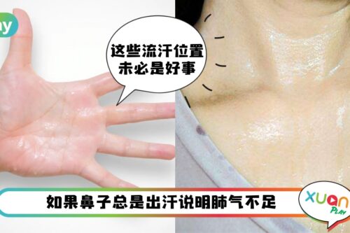 健康 I 不是会出汗就一定很健康！身体6处异常出汗是疾病的信号