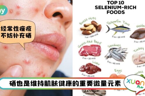 Tips I 缺“硒”皮肤容易变老和长痘！生活中10个含硒量丰富的食物