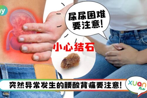 健康｜肾结石会让人痛到歪腰？背痛、频尿恐是肾结石征兆