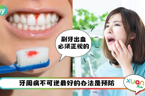 健康 I 刷牙流血？口臭不散？这是“青年型牙周病”的症状