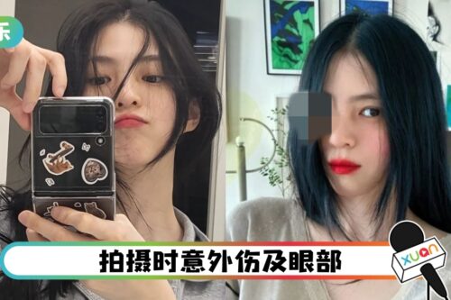 怕粉丝吓坏！韩素希受伤后首发自拍…头发遮眼