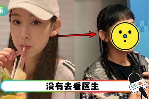 炎明熹“满脸爆痘”吓坏人!承认:睡不好