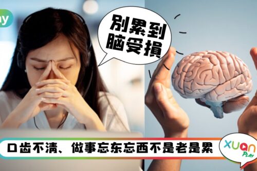 Tips｜脑过劳怎么办？医：多发呆！4个脑过劳的危险信号！