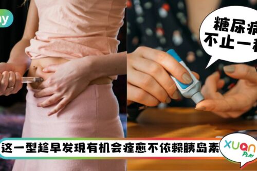 健康｜你以为糖尿病只有一种？年轻人最容易被第二型盯上！