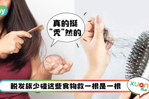 Tips I 脱发又关它们事？生活中7类易引起脱发的食物