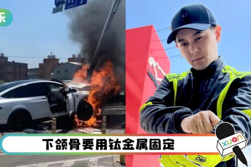 林志颖最新病况曝光！做完颜面手术 靠插喉进食