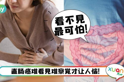健康|余苑绮患直肠癌病逝,身体、排便若出现这4异状赶快就医!