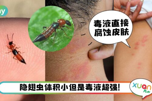 Tips｜遇到隐翅虫绝对不要拍打！3招避开、预防这让人毁容的小虫