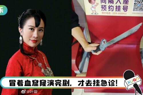 叶璇被道具刀戳中脸部! 伤口深2CM恐破相