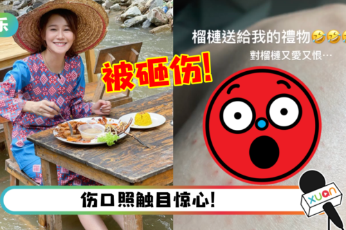 黄翠如来马拍摄节目惨遭榴莲砸中！大腿被“开了20个孔”