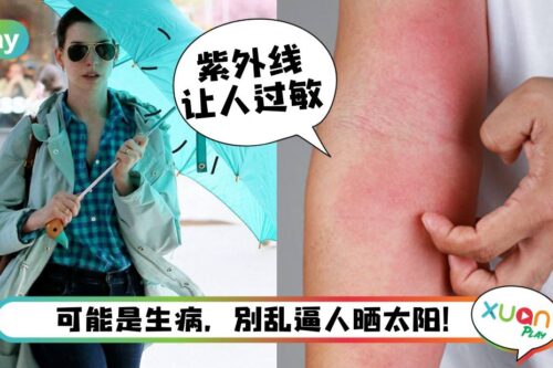 Tips｜不能晒太阳就是矫情？这3种病真的必须躲避阳光！