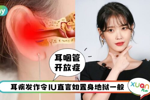 健康 I IU患上的“耳咽管开放症”是什么？减肥过度也会造成！