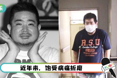 “男吹神”拓也哥逝世！去年因糖尿病恶化截肢