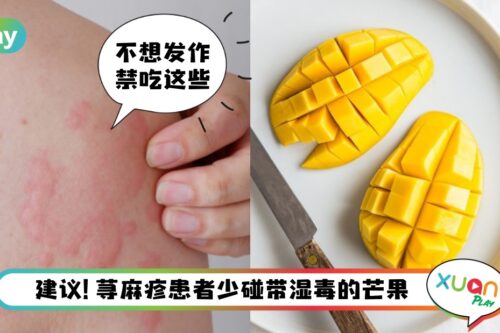 Tips I 荨麻疹奇痒难耐！生活中5种食物建议尽量少碰