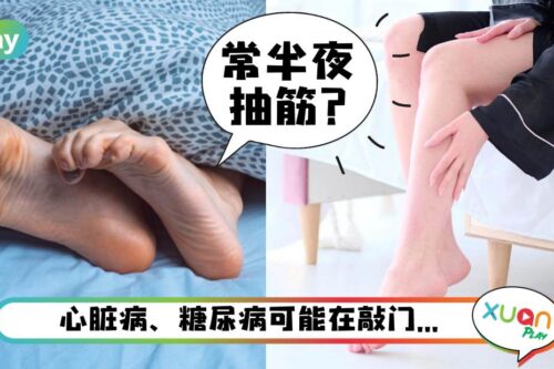 健康 I 夜间总是腿抽筋还痛到不行，除了缺钙还有这3个病因