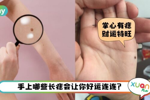 命理 I 手上有痣都好运！快来比对你手上的痣代表哪些运气