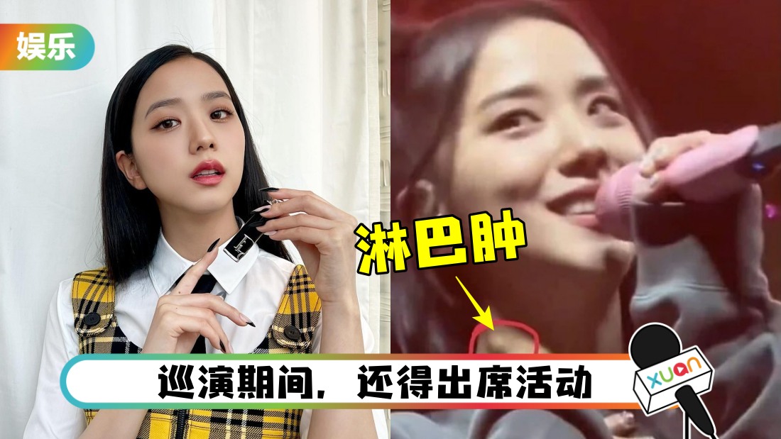 疑操劳过度！BLACKPINK Jisoo被拍到“脖子肿一块”