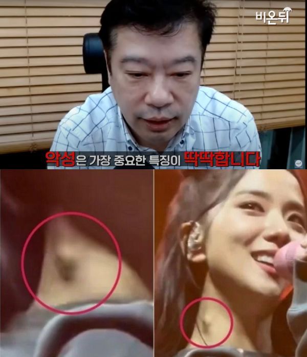 Jisoo被医生建议