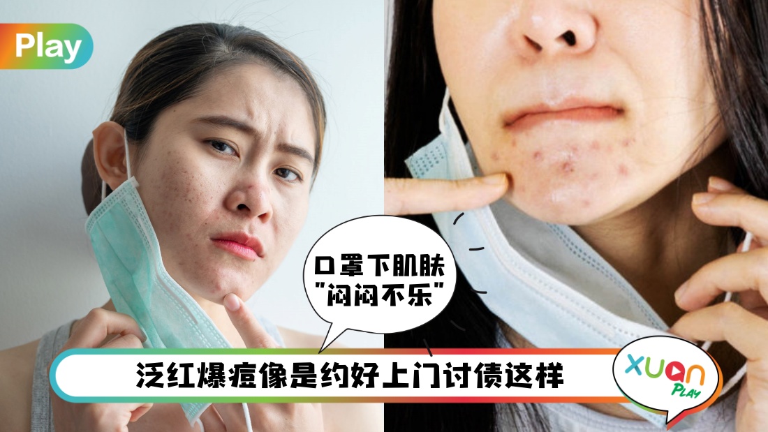 Tips I 戴口罩造成的痘痘“危肌”，3大自救攻略看这里！
