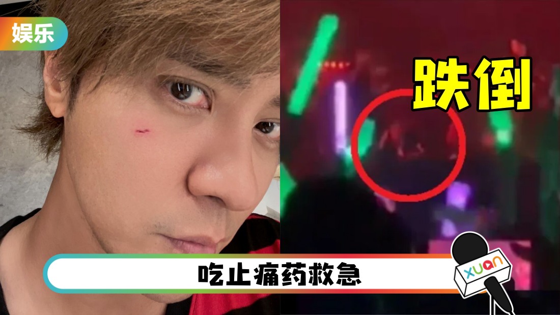 罗志祥台上跌倒！证实“小腿胫骨撞2次”肿起来