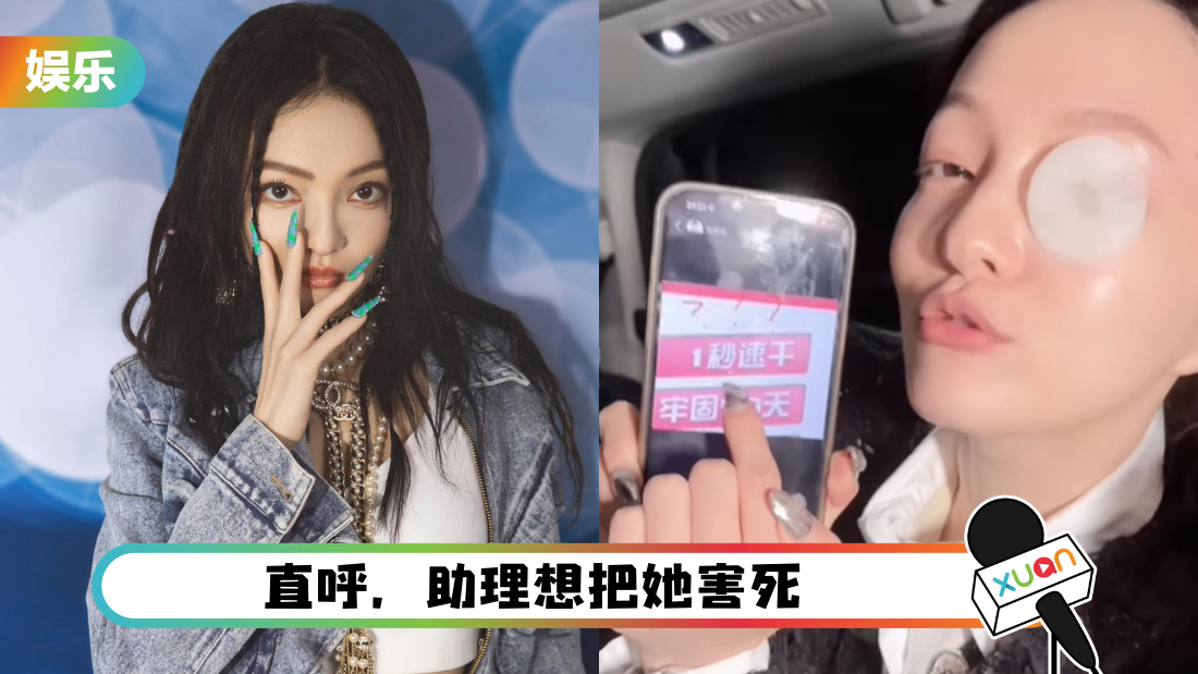 假睫毛卸了2小时都卸不掉!眼皮红肿 张韶涵当场崩溃