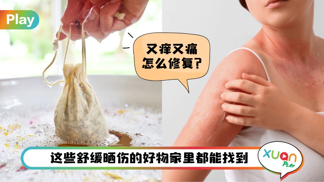 Tips I 脱皮小事最怕皮肤癌！海边晒伤6种舒缓急救法