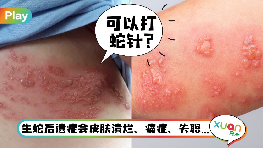 健康I 新冠康复后免疫力急降！生蛇的机率居然高5倍！