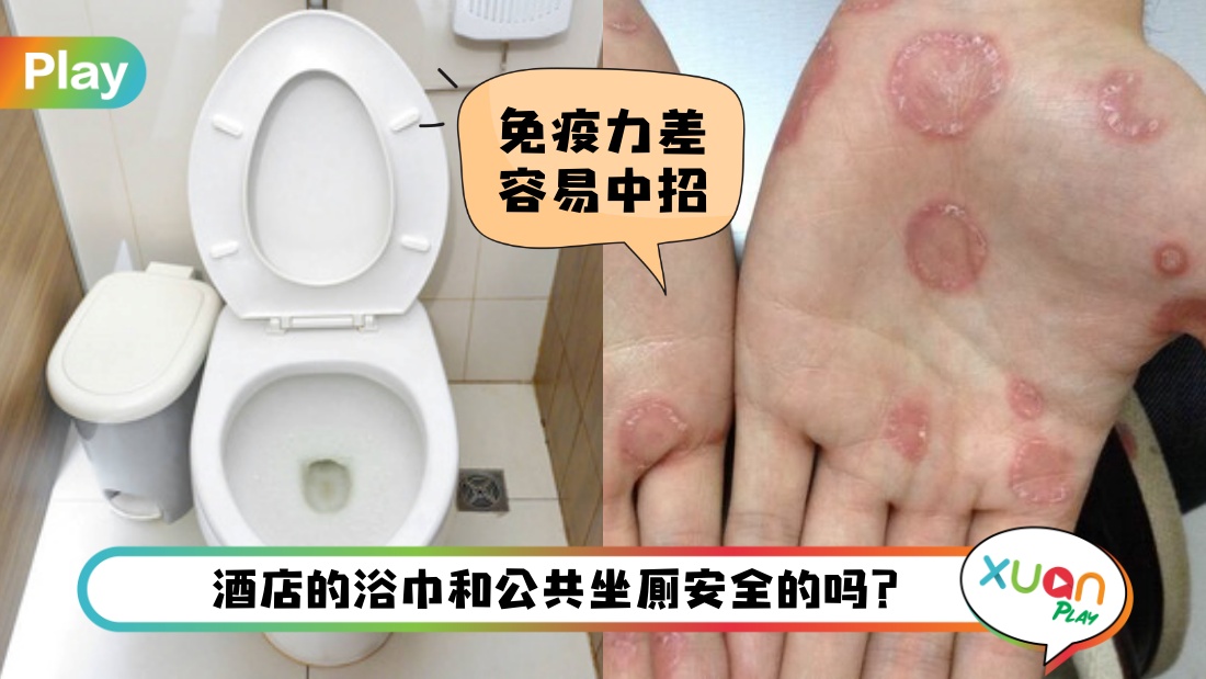 健康 I 公共坐厕也有风险？没有性生活也会从这些途径感染上性病！