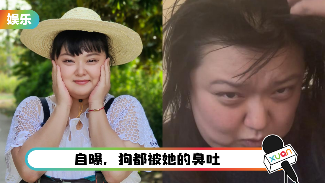 细细粒确诊!迷信“三天不洗头、不洗澡” 怕毛孔会扩张