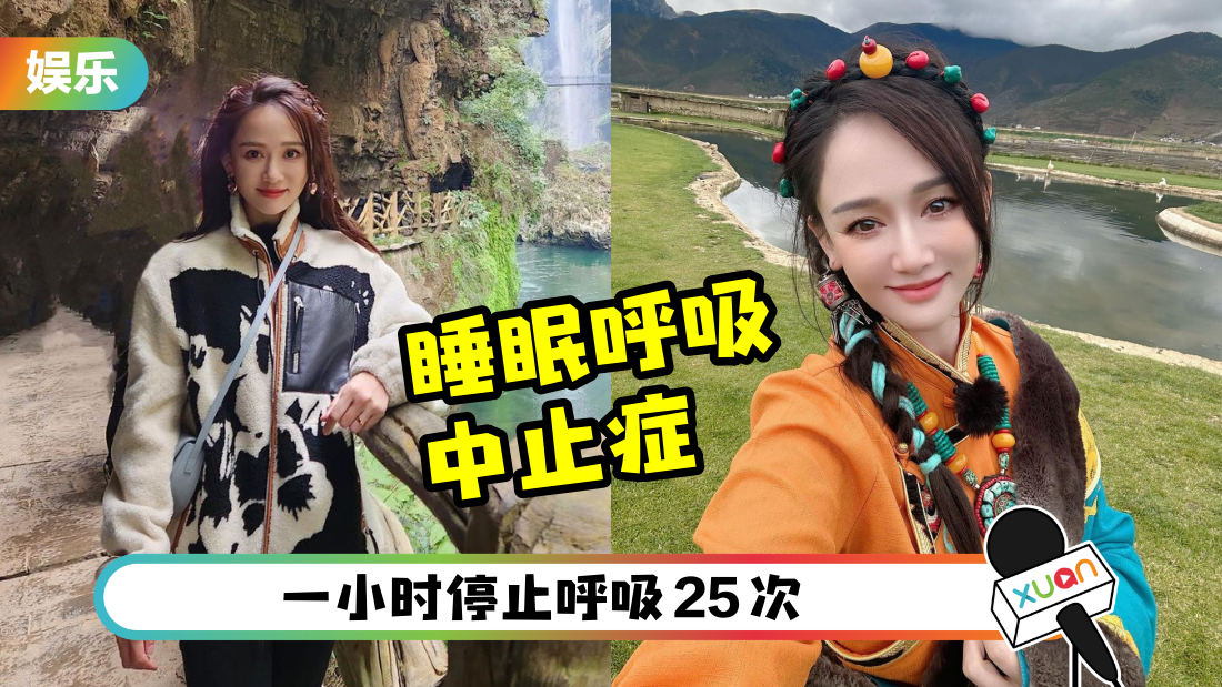 陈乔恩睡觉打呼…老公发现她没呼吸！医生诊断后证患病！