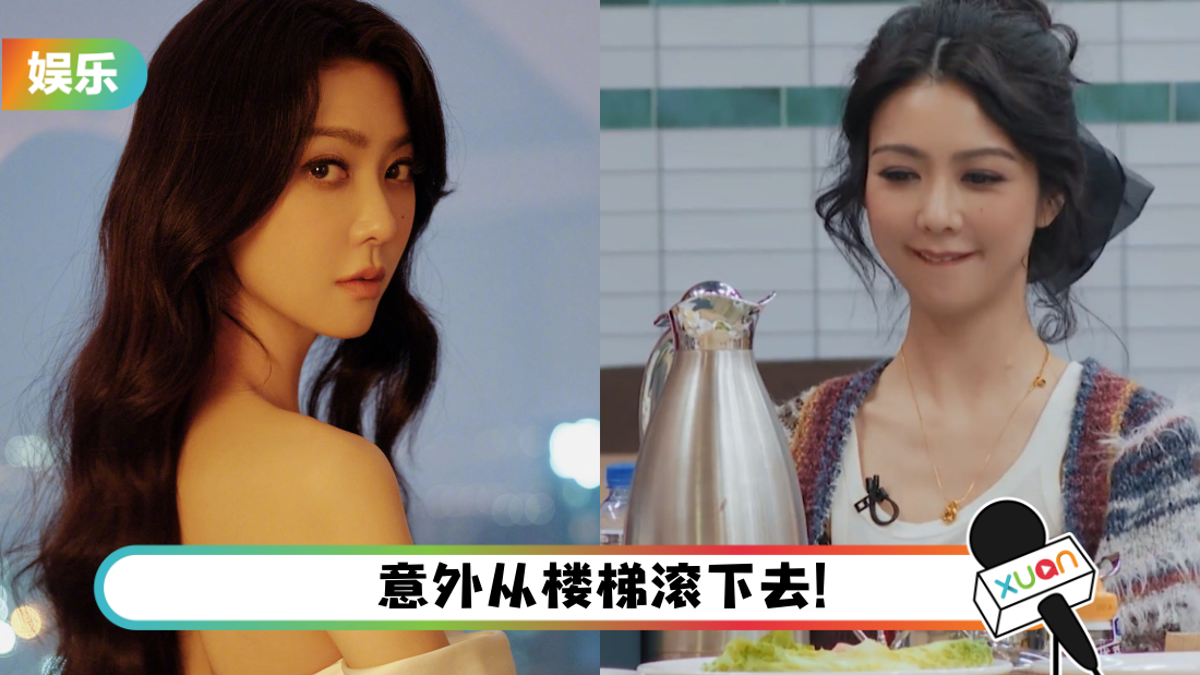 薛凯琪自曝演出前牙齿破掉！佘诗曼调侃：会“漏风”吗？